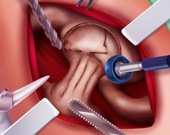 Принцесса: операция на бедре